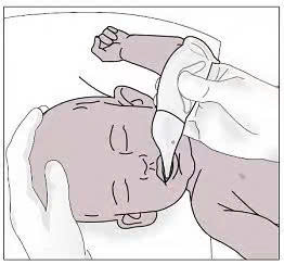 Penguin suction device